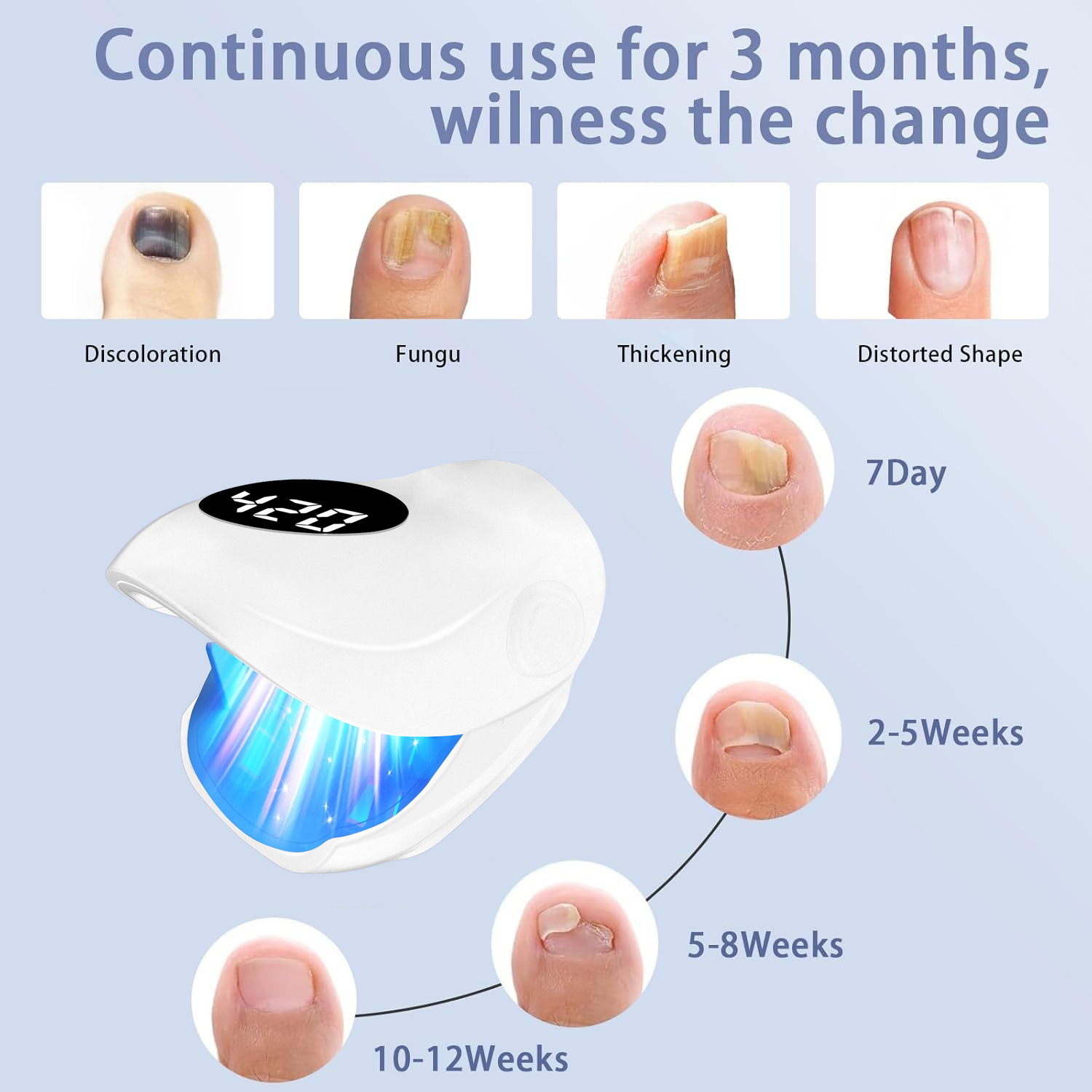 USB Charging Nail Fungus Treat - Galvanic Skin Sensor review and price